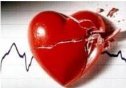 Insuficiencia cardíaca | Recurso educativo 74805